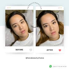 Waralaba Hera Beauty Choice