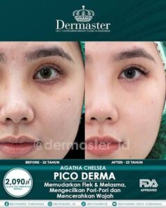 Kemitraan Dermaster