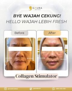 Waralaba Gaura Skin Clinic